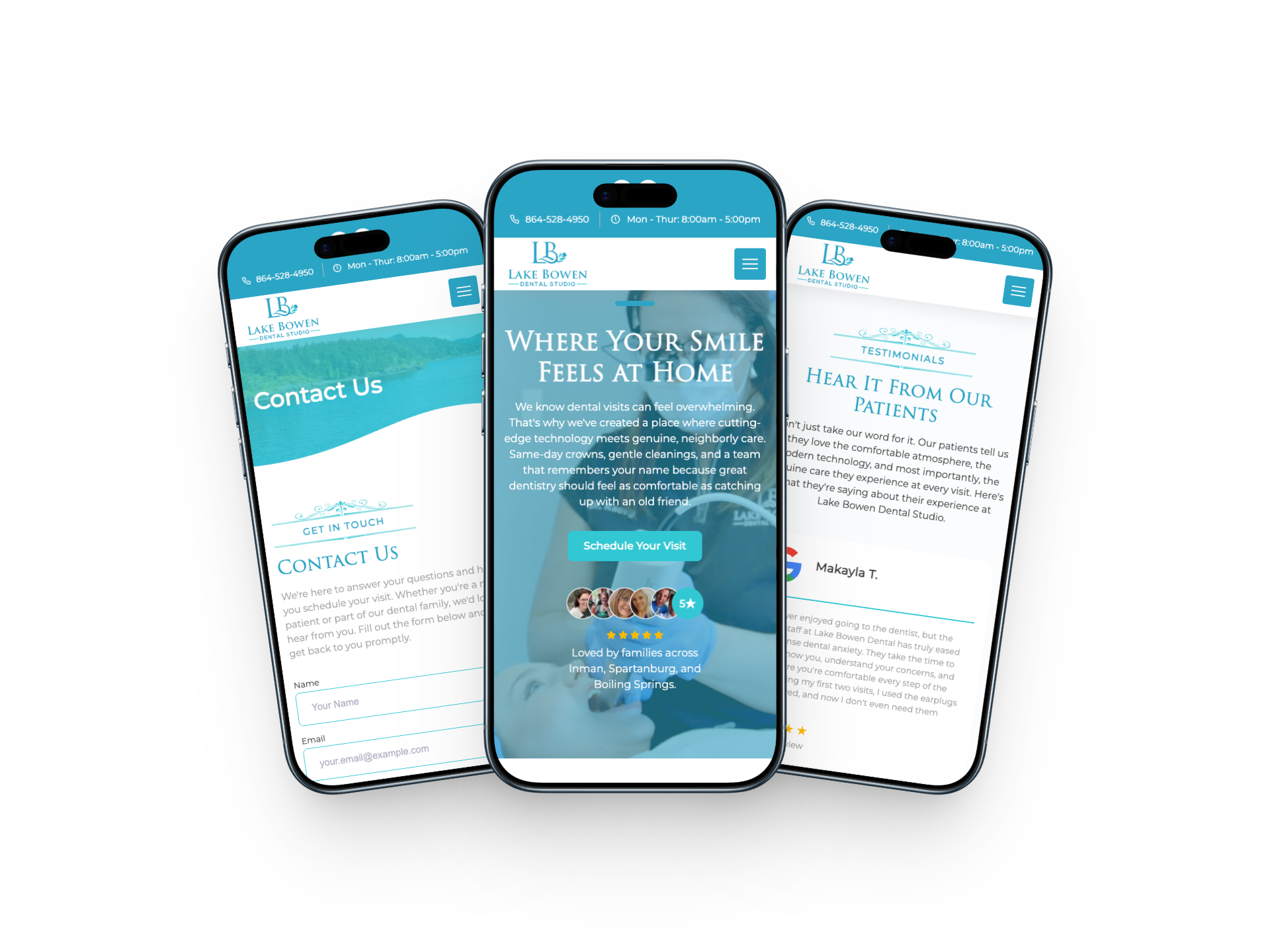 Custom dental website displayed across three mobile phones showing fast load performance and clean layout
